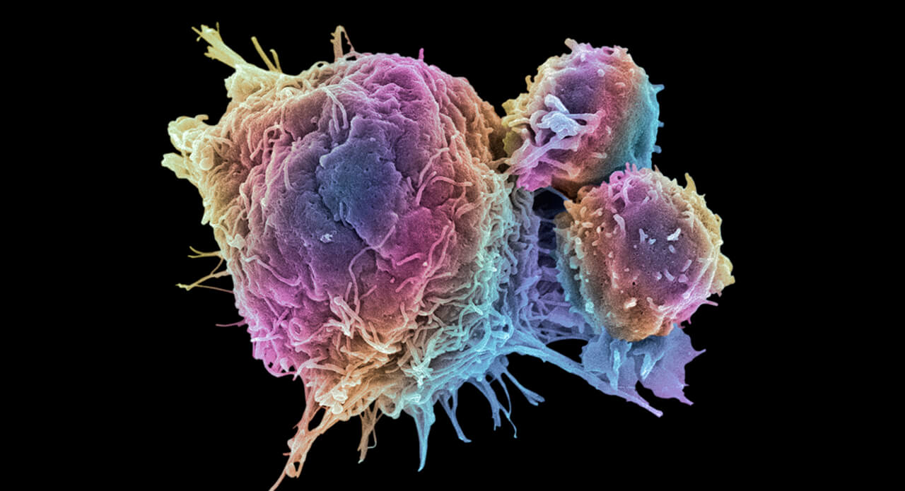 cancer_cell_and_t_lymphocytes_sem_1280x695.jpg